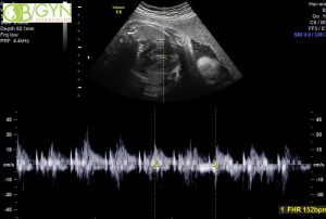Ultrasound image